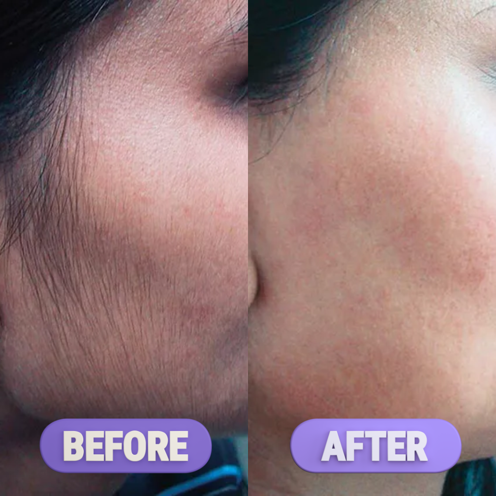 Plux Pro | Gesichtshaar-Entferner